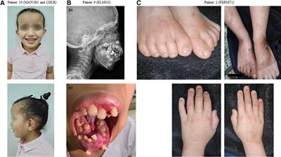 Clinical exome sequencing by general pediatricians: high clinical utility and no evidence of inappropriate testing